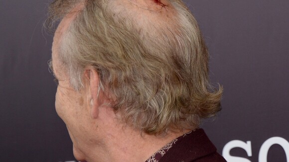 Bill Murray vai a lançamento de filme com a cabeça sangrando. Veja foto