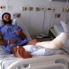 Kiko Pissolato quebrou o pé em março deste ano