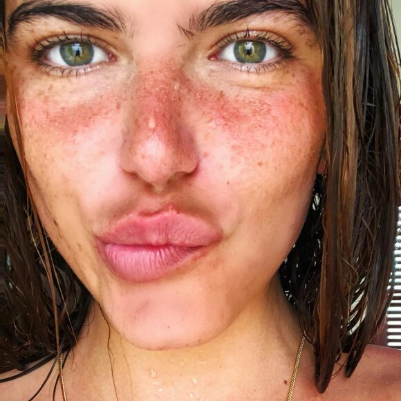 Mariana Goldfarb contou que suas sardas eram sua 'maquiagem de verão' em selfie postada na web