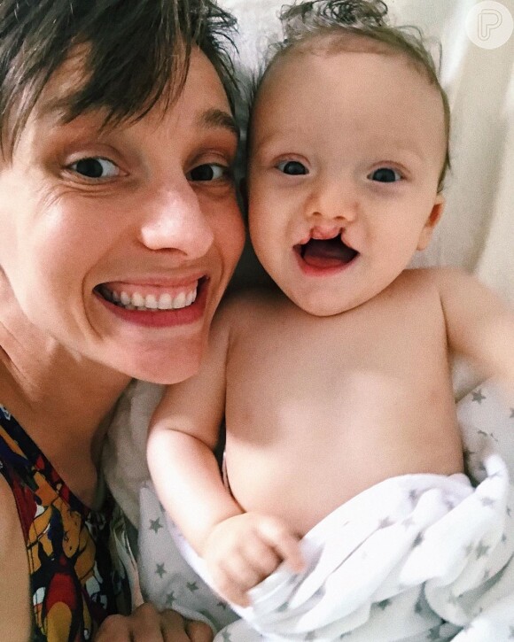 Isabel Hickmann deu detalhes da primeira cirurgia do filho de 9 meses