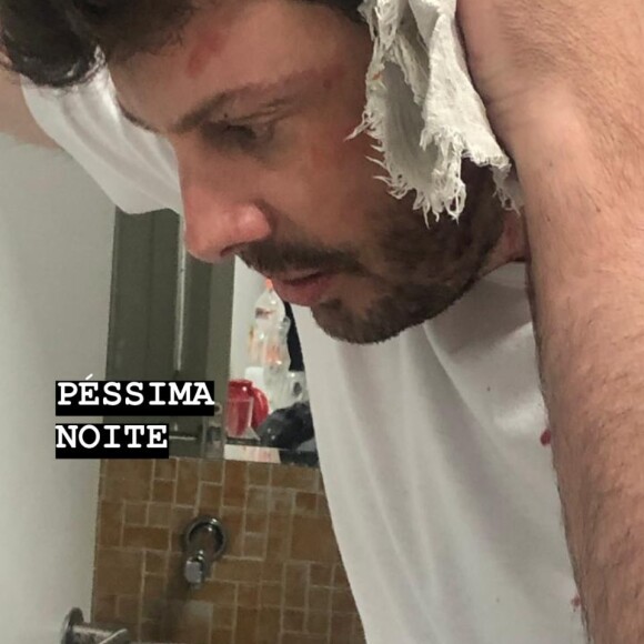 Danilo Gentili mostrou camisa suja após ser atingido com garrafada pelo humorista Diguinho Coruja durante gravação na TV