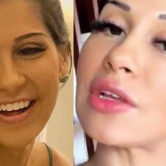 Veja antes e depois de preenchimento labial de Mayra Cardi. Saiba!