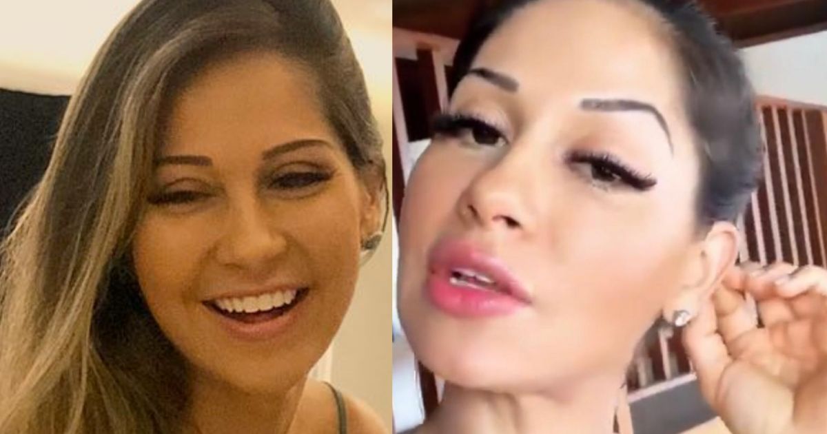 Veja antes e depois de preenchimento labial de Mayra Cardi ...