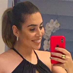 Naiara Azevedo assumiu procedimentos estéticos