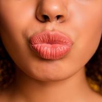 Rugas nos lábios: saiba como prevenir o famoso código de barras na boca!