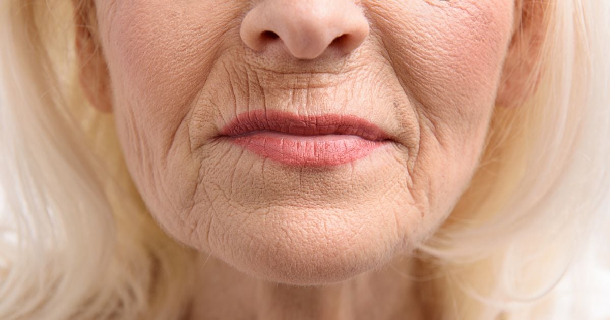 Rugas nos lábios: compressa de água quente pode diminuir - Purepeople