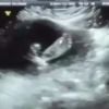 Petrix Barbosa mostra ultrassom do bebê com Joline Heitmann