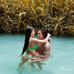 Namorada de Whindersson Nunes exibe antes e depois de preenchimento labial