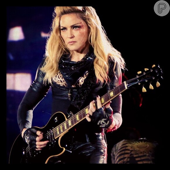 Madonna levou um soco durante uma apresentação e postou a foto na rede social