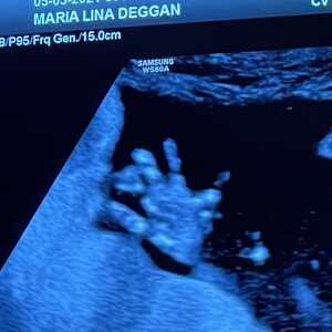 Filho de Whindersson Nunes e Maria Lina, João Miguel está em uma UTI neonatal