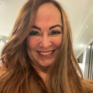 Nadine Gonçalves já fez harmonização facial e aprovou resultado