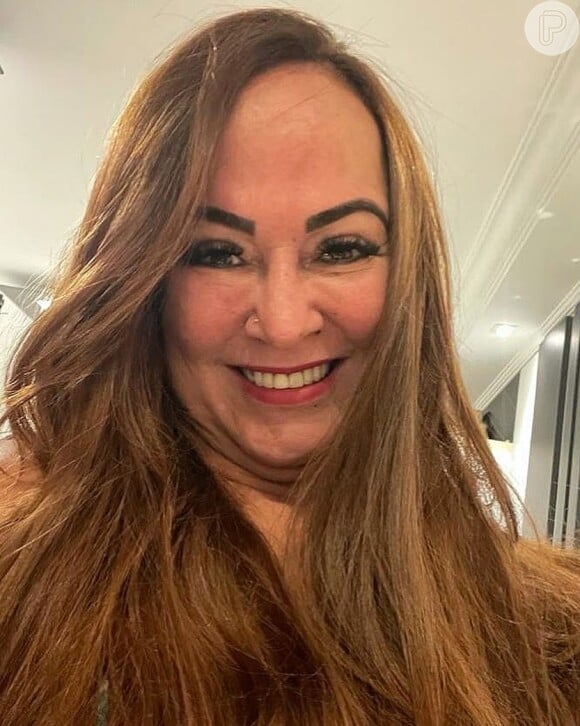 Nadine Gonçalves já fez harmonização facial e aprovou resultado