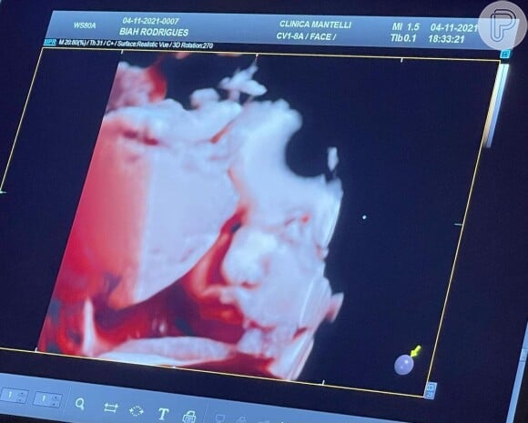 Biah Rodrigues mostrou o rosto da filha em ultrassom 3D