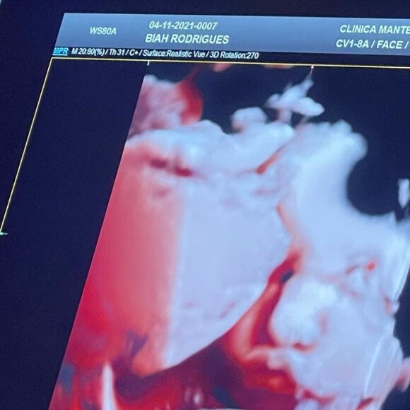 Biah Rodrigues mostrou o rosto da filha em ultrassom 3D