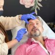 Esteticista Tonya Beauty explicou como funciona procedimento de rejuvenescimento facial feito por Luigi Baricelli