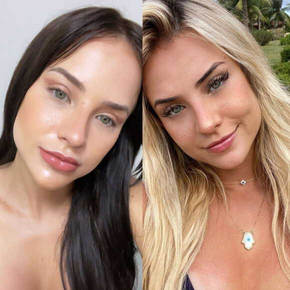 Antes e depois: Gabi Martins fez harmonização facial e realçou seus traços