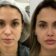 Antes e depois: Sarah Andrade fez harmonização facial e realçou seus traços