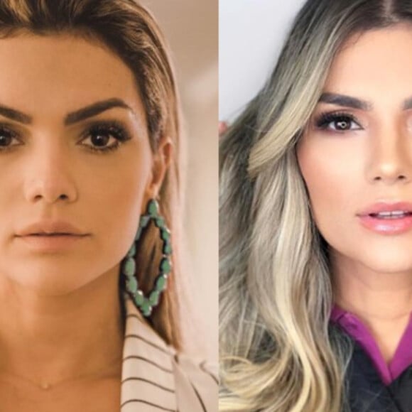 Antes e depois: Kelly Key fez harmonização facial e realçou seus traços