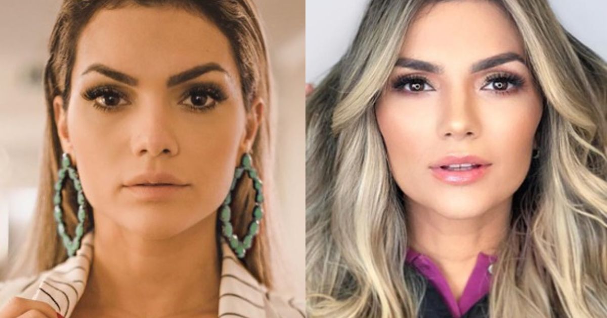 Antes e depois Kelly Key fez