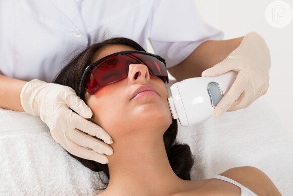 Depilação a laser pode ser feita no rosto: especialista lista cuidados sobre procedimento