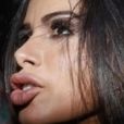 Anitta surgiu com lábios mais grossos após preenchimento labial