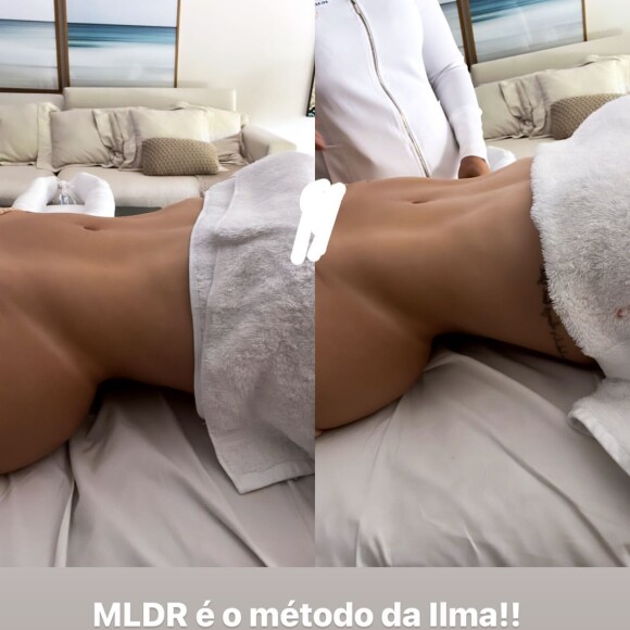 Virgínia Fonseca mostrou antes e depois de sessão de drenagem linfática