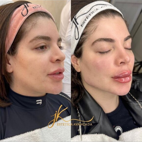O antes e depois do rosto de GKay surpreendeu