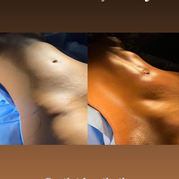 Antes e depois do corpo de Mileide Mihaile recebe elogios de famosos