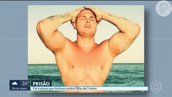 Filho de José Lucas Dias Barreto, ex-'Fazenda de Verão', fraturou o ombro e precisou passar por uma cirurgia