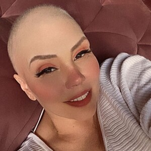 Simony sofreu com a perda de cabelo em tratamento contra o câncer
