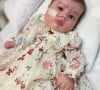 Filha de Juliano Cazarré e Letícia precisou ser operada horas depois do parto