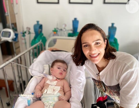 Maria Guilhermina, filha de Juliano Cazarré: a cirurgia pós-parada cardíaca durou seis horas e correu tudo bem. No entanto, uma lesão deixou a bebê temporariamente paralisada