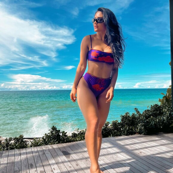 Lipo LAD de Mileide Mihaile fez sucesso na web pelo aspecto natural
