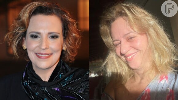 Guta Stresser e Ana Beatriz Nogueira são exemplos de famosas com Esclerose Múltipla.
