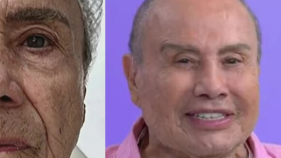 Harmonização facial de Stênio Garcia aos 91 anos: ator manda a real após críticas e memes por aparência. 'C*guei'