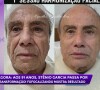 Harmonização facial de Stenio Garcia: ator realizou uma série de procedimentos no rosto