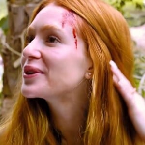 Marina Ruy Barbosa mostra falso machucado para contar um pouco mais sobre seu novo trabalho na Globo.