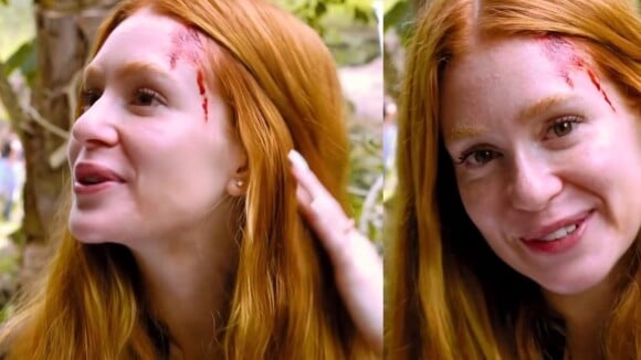 'Bem... Louca!': Marina Ruy Barbosa surge sangrando em vídeo da Globo pelo motivo você não esperava. Confira!