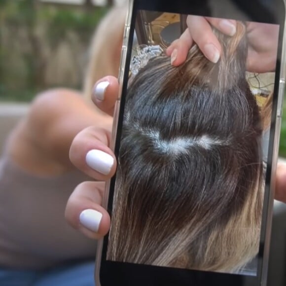 Virgínia Fonseca perdeu o cabelo por conta do estressa causado sobre a qualidade da sua base