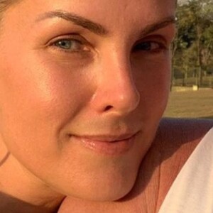 Ana Hickmann acusa Alexandre Correa de agressão