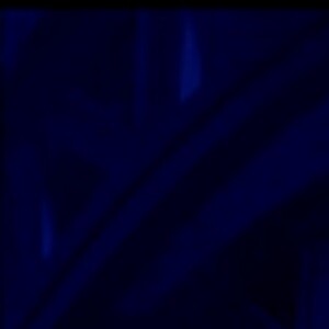 Mingau: rara foto do baixista no hospital foi divulgada no programa 'The Noite'