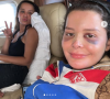 Maraisa mostrou o rosto machucado depois de acidente em jacuzzi