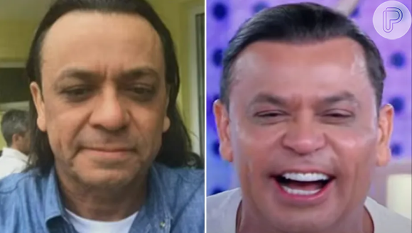 Frank Aguiar fez harmonização facial e revelou resultado no 'Fofocalizando', no SBT