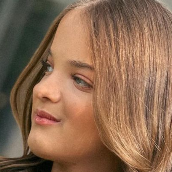 Rafaella Justus fez harmonização facial? Especialista no procedimento aponta possível cirurgia feita pela jovem aos 14 anos