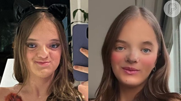 Rafaella Justus antes e depois: outubro de 2023 e fevereiro de 2024, após a rinoplastia