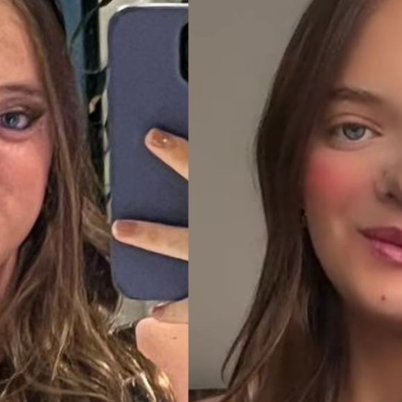Rafaella Justus antes e depois: outubro de 2023 e fevereiro de 2024, após a rinoplastia