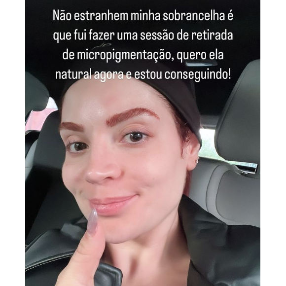Gkay compartilhou que está removendo a micropigmentação de suas sobrancelhas