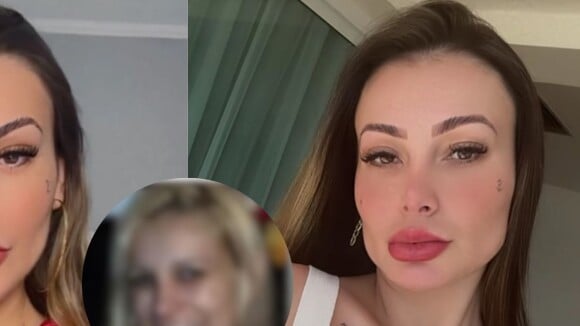 Antes e depois de Andressa Urach: modelo posta foto antes da fama e aparência IRRECONHECÍVEL rouba a cena. 'É cirurgia'