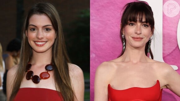 Anne Hathaway afinou seu nariz com tanta sutileza que você nunca percebeu a cirurgia