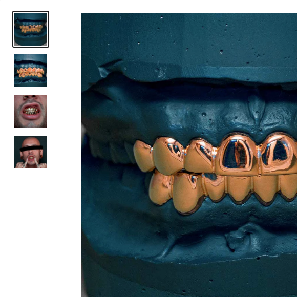 Um dos grillz comprados por MC Daniel é de prata banhada a ouro 18 quilates e custa quase R$ 12 mil